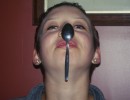 Freak cutlery accident